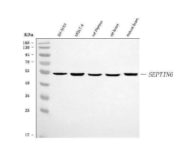 Anti-SEPT6/SEPTIN6 Antibody Picoband® Boster Bio