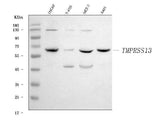 Anti-TMPRSS13 Antibody Picoband® Boster Bio