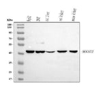 Anti-MOGAT2 Antibody Picoband® Boster Bio