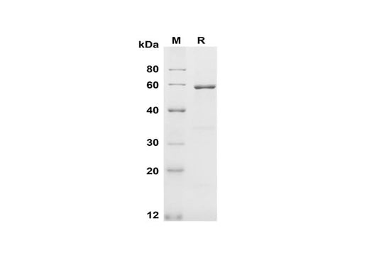 SDS-PAGE analysis of Human Kallikrein 3/PSA proteins, 2 μg/lane of Recombinant Human Kallikrein 3/PSA proteins was resolved with SDS-PAGE under reducing conditions, showing bands at 60 kDa.