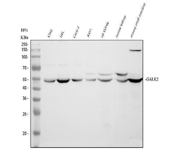 Anti-GALK2 Antibody Picoband® Boster Bio