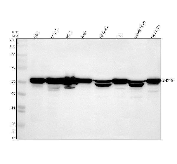 Anti-SNX16 Antibody Picoband® Boster Bio