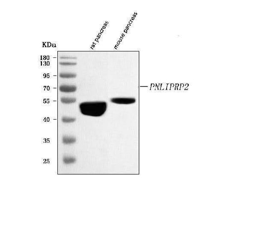 Anti-PNLIPRP2 Antibody Picoband® Boster Bio