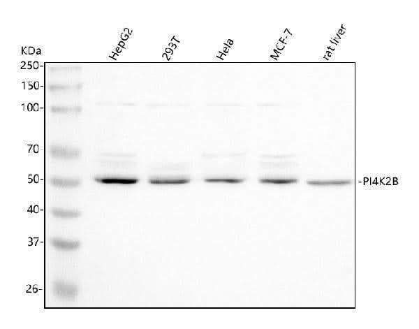 Anti-PI4K2B Antibody Picoband® Boster Bio