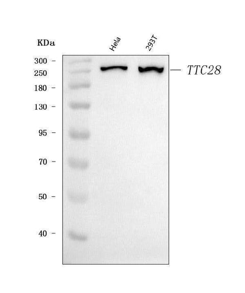 Anti-TPRBK/TTC28 Antibody Picoband® Boster Bio