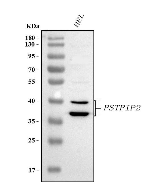Anti-PSTPIP2 Antibody Picoband® Boster Bio