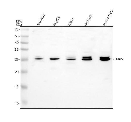 Anti-FKBP7 Antibody Picoband® Boster Bio