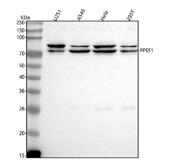 Anti-PPEF1 Antibody Picoband® Boster Bio