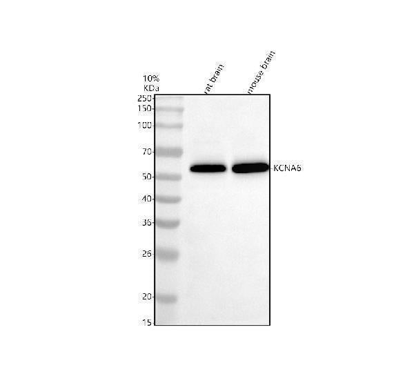 Anti-KCNA6 Antibody Picoband® Boster Bio