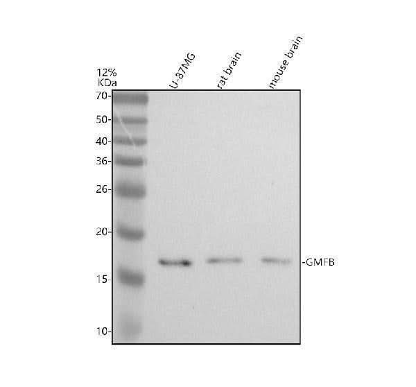 Anti-GMF Beta/GMFB Antibody Picoband® Boster Bio