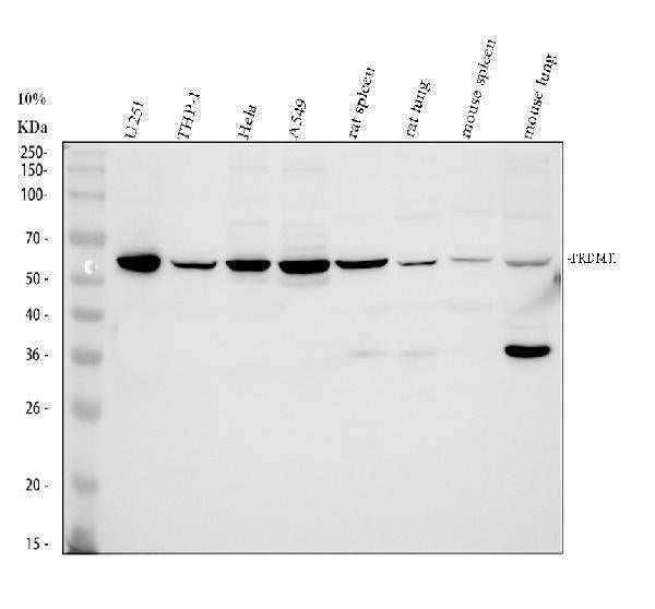 Anti-PRDM11 Antibody Picoband® Boster Bio