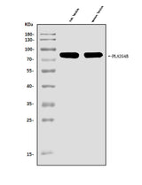 Anti-cPLA2 beta/PLA2G4B Antibody Picoband® Boster Bio