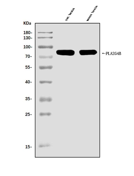 Anti-cPLA2 beta/PLA2G4B Antibody Picoband® Boster Bio
