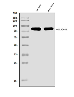 Anti-cPLA2 beta/PLA2G4B Antibody Picoband® Boster Bio