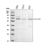 Anti-PALMD Antibody Picoband® Boster Bio