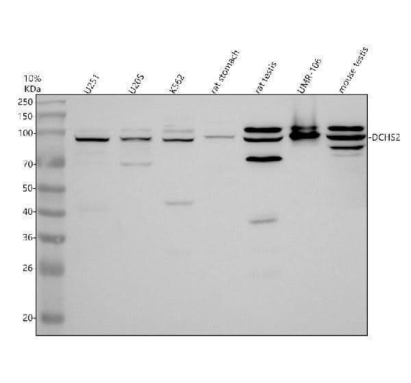 Anti-DCHS2 Antibody Picoband® Boster Bio