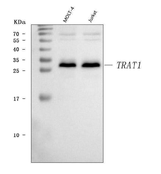 Anti-TRAT1 Antibody Picoband® Boster Bio