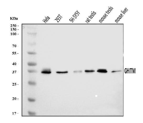 Anti-GHITM Antibody Picoband® Boster Bio