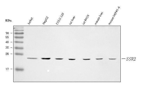Anti-TRAPB/SSR2 Antibody Picoband® Boster Bio
