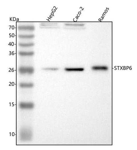 Anti-STXBP6 Antibody Picoband® Boster Bio