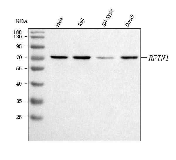 Anti-RFTN1 Antibody Picoband® Boster Bio