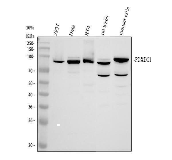 Anti-PDXDC1 Antibody Picoband® Boster Bio