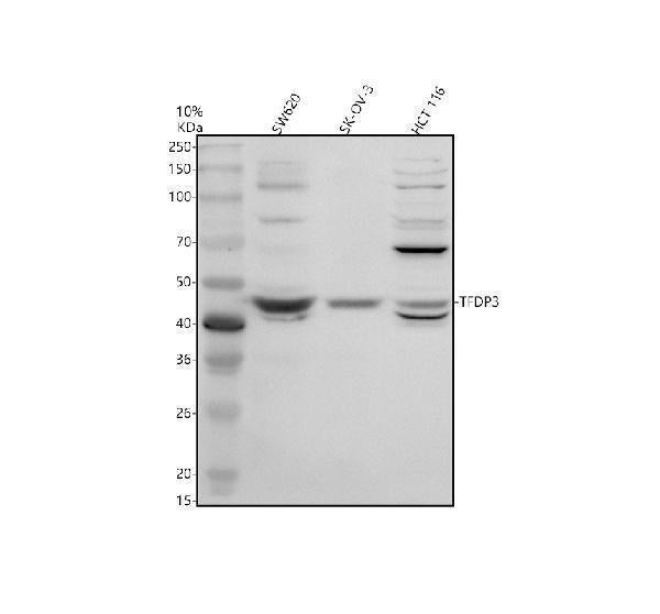 Anti-TFDP3 Antibody Picoband® Boster Bio