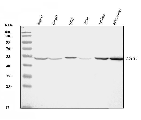Anti-AQP11 Antibody Picoband® Boster Bio