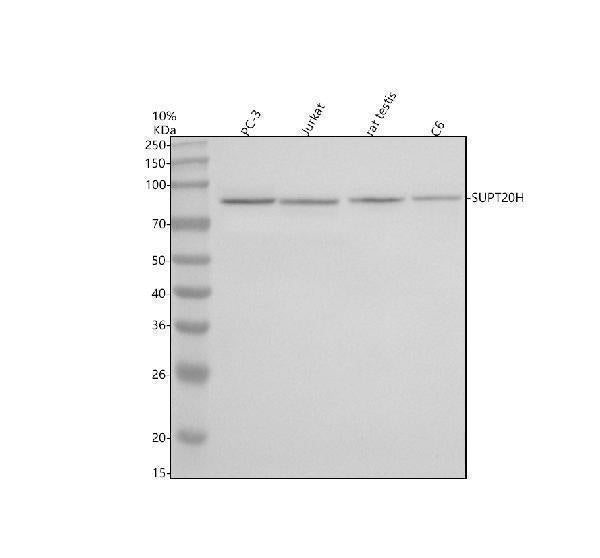 Anti-SUPT20H Antibody Picoband® Boster Bio