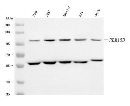 Anti-RBM15B Antibody Picoband® Boster Bio