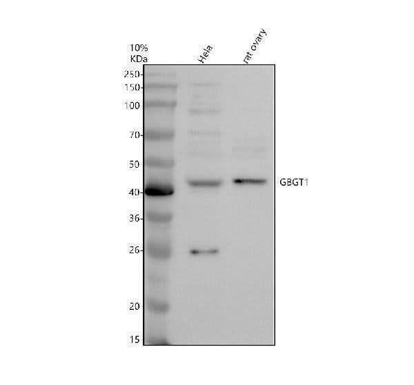 Anti-GBGT1 Antibody Picoband® Boster Bio