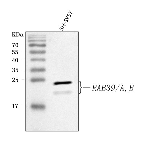 Anti-RAB39A/B Antibody Picoband® Boster Bio