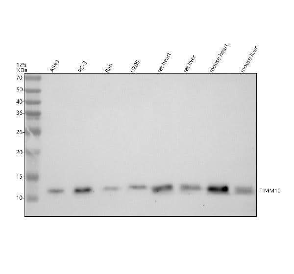Anti-TIM10/TIMM10 Antibody Picoband® Boster Bio