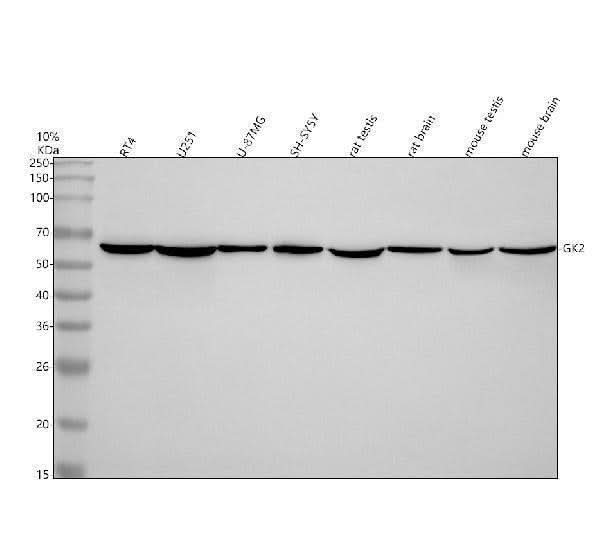 Anti-GK2 Antibody Picoband® Boster Bio