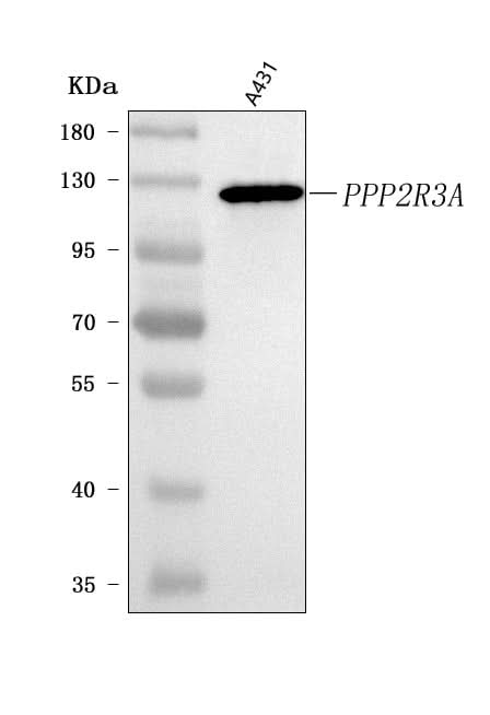 Anti-PPP2R3A Antibody Picoband® Boster Bio