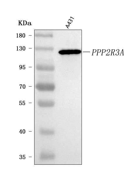 Anti-PPP2R3A Antibody Picoband® Boster Bio