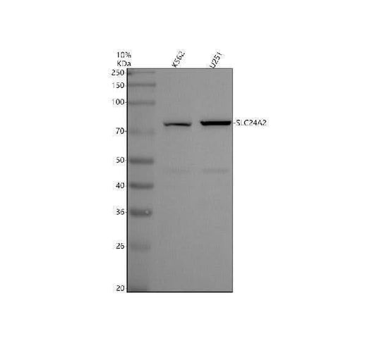Anti-SLC24A2 Antibody Picoband® Boster Bio