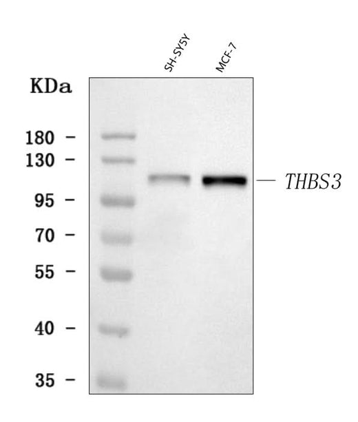 Anti-THBS3 Antibody Picoband® Boster Bio