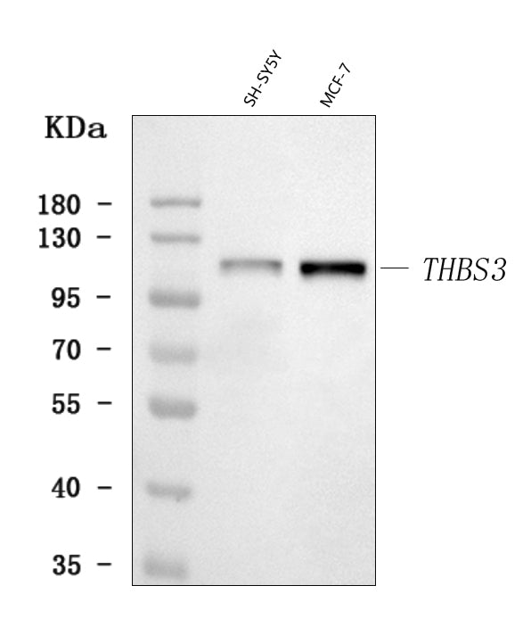 Anti-THBS3 Antibody Picoband® Boster Bio