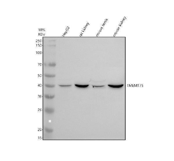 Anti-TMEM175 Antibody Picoband® Boster Bio