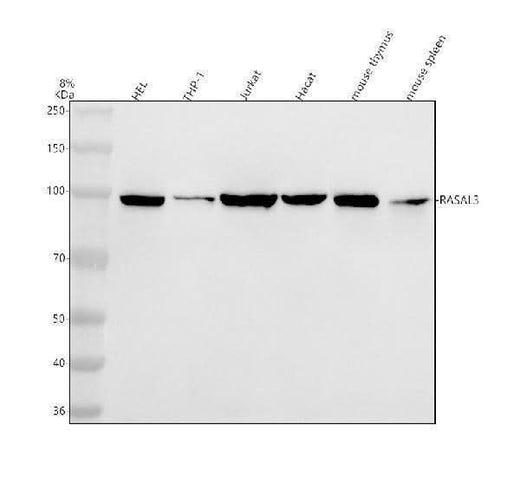 Anti-RASAL3 Antibody Picoband® Boster Bio