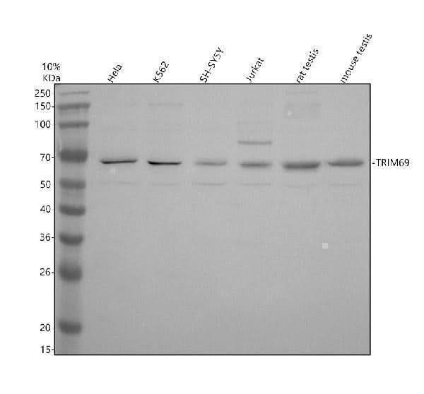 Anti-TRIM69 Antibody Picoband® Boster Bio