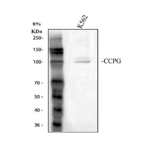 Anti-CCPG1 Antibody Picoband® Boster Bio