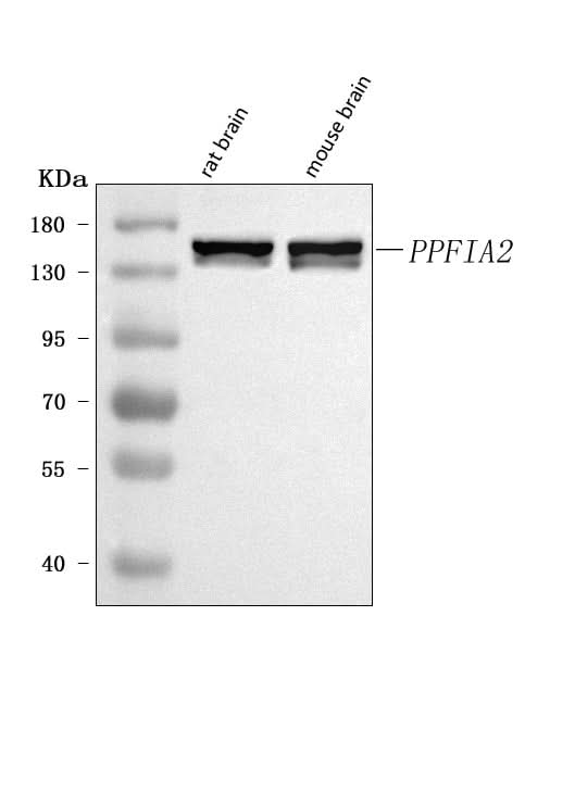 Anti-PPFIA2 Antibody Picoband® Boster Bio