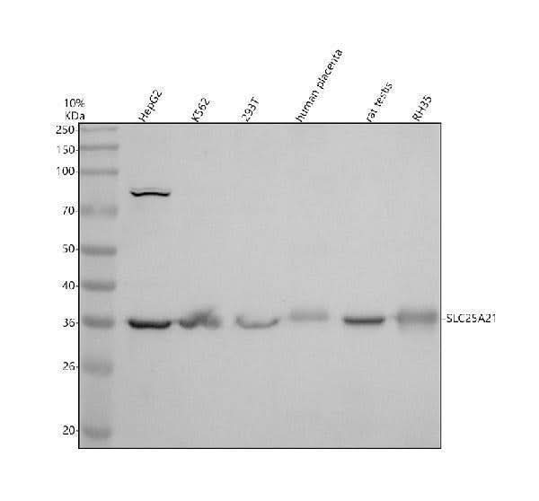 Anti-SLC25A21 Antibody Picoband® Boster Bio