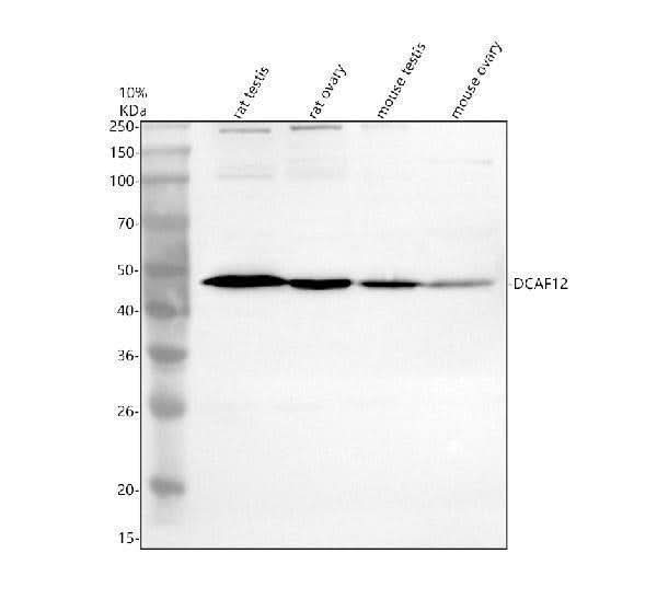 Anti-DCAF12 Antibody Picoband® Boster Bio