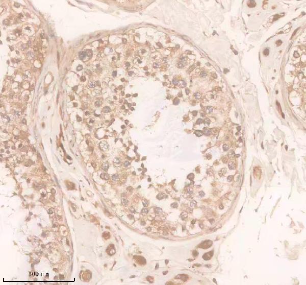 Anti-DAND5 Antibody Boster Bio