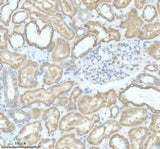 Anti-SLC9A7 Antibody Boster Bio