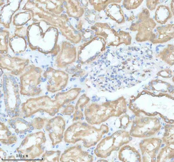 Anti-SLC9A7 Antibody Boster Bio