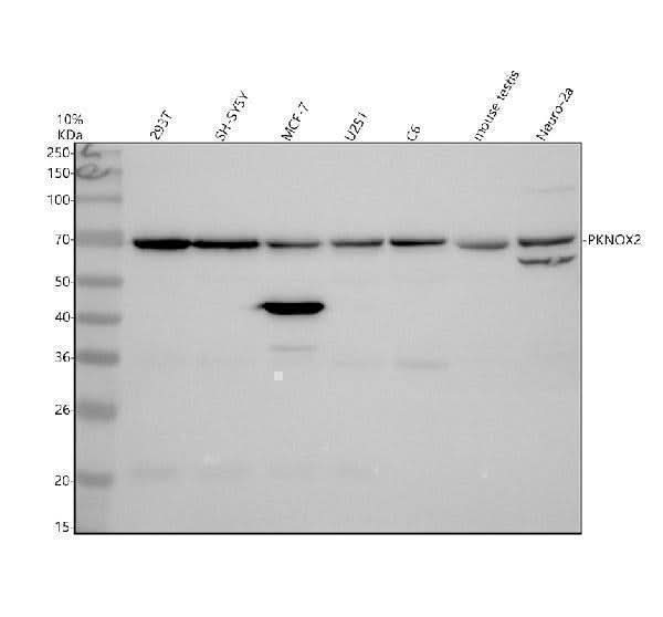 Anti-PKNOX2 Antibody Picoband® Boster Bio